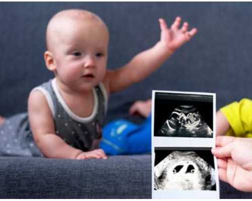 原来肥胖对女性的伤害是这么大的啊？