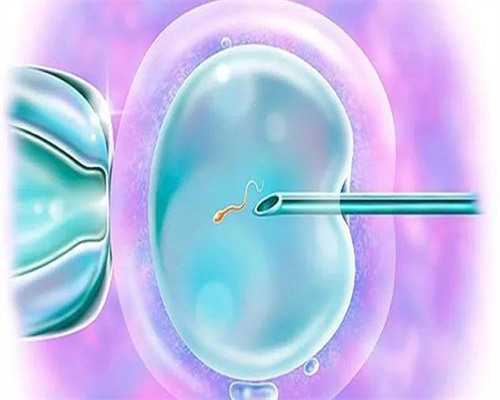 一站式代孕服务,俄罗斯试管婴儿流程