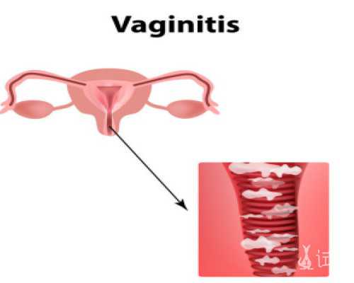代孕靠谱机构哪里有,怎么开启微信运动步数排行（怎么开启微信运动步数）