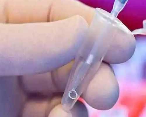 最大的代孕公司,精子质量不佳吃锌硒宝多久能见效?